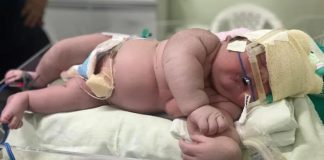 Bebê gigante nasce com mais de 7 kg em maternidade de Parintins